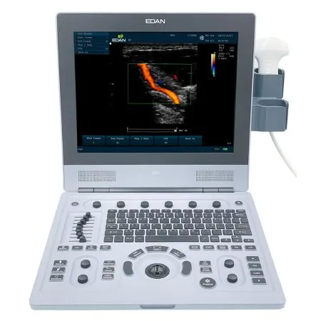 Edanusa & Mdpro - Edan U60 - U60-D - Ultrasound System Edan U60