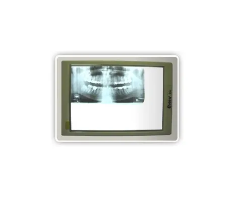 Dent Corp - 610 - E-View X-Ray Viewer
