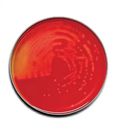 BD - 221261 - Prepared Media Bd Bbl Trypticase Soy Agar With 5% Sheep Blood (Tsa Ii) Dark Red Mono-Plate Format