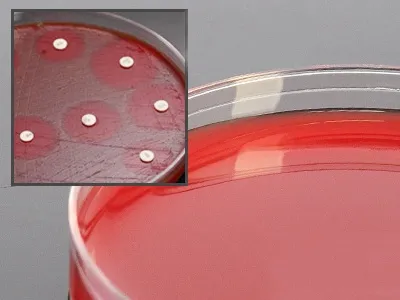 Hardy Diagnostics - A59 - Prepared Media Mueller Hinton Agar With 5% Sheep Blood Plate Format