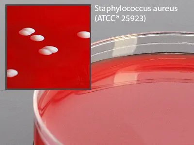 Hardy Diagnostics - A50BX - Prepared Media Columbia Naladixic Acid (can) Agar Red Petri Plate Format