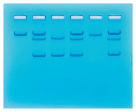 Fisher Scientific - Edvotek - S94670 - Edvotek Sickle Cell Gene Detection (dna-based) Classroom Educational Kit 8 Gels, 45 Minutes Time Range, Refrigerated